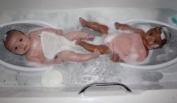 Cặp song sinh khác màu da khiến mẹ ruột cũng phải chấn động