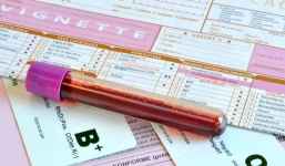 Đây là nhóm máu có nguy cơ mắc tiểu đường thấp nhất