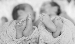 Cặp sinh đôi khác cha khiến mẹ ruột cũng choáng váng