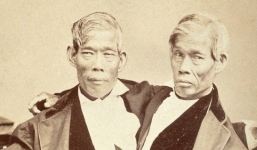 Bí ẩn 2 anh em song sinh dính liền lấy 2 chị em, sinh được 21 người con và có 1.500 hậu duệ