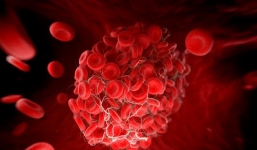 Phát hiện một biến chứng của Covid kéo dài có thể nguy hiểm tính mạng