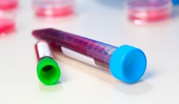 Phát hiện yếu tố trong máu gây tiểu đường, bệnh K sau 22 năm nghiên cứu