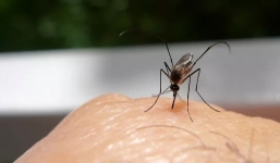 7 lý do khiến muỗi thích đốt người này hơn người khác