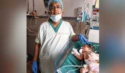 Cực hiếm: Phát hiện 8 bào thai trong bụng em bé 21 ngày tuổi