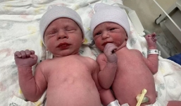 Cặp song sinh chào đời sau 30 năm 'ngủ đông'