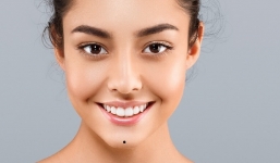 Nhận diện 9 nốt ruồi xấu trên mặt khiến chủ nhân hao tài tốn của, tình duyên lận đận