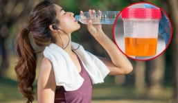 Có 3 dấu hiệu này sau khi uống nước thì đi khám nhanh còn kịp, một bộ phận quan trọng đang thầm kêu cứu