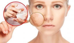 Nếu còn phạm 5 sai lầm khi chăm sóc da này thì dùng mỹ phẩm đắt tiền cũng công cốc