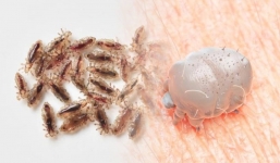 7 sinh vật đang mở tiệc, sinh con đẻ cái trên da người, sạch sẽ đến mấy cũng có nguy cơ mắc phải