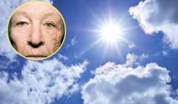 Bức ảnh sống động về tác hại của ánh nắng với làn da khiến mọi cô gái run rẩy, quay sang cuồng kem chống nắng