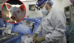 Cấy ghép thận lợn sang người thành công, hoạt động tốt trong 1 tháng và chưa có dấu hiệu dừng lại