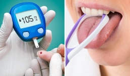 Muốn biết đường huyết cao hay thấp, nhìn vào lưỡi xem có 3 dấu hiệu này không