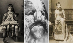 9 dị nhân có thật, được mệnh danh 'quái vật' trong lịch sử loài người