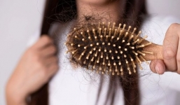 Tránh xa nước nóng và 7 bí kíp ngăn rụng tóc mùa đông cần làm ngay để cứu vãn mái tóc