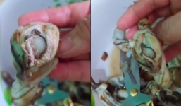 Đăng clip ốc móng tay có sán, cô gái bị 'bóc mẽ' thiếu hiểu biết