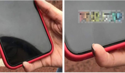 Hoang mang trước ngón tay cong vẹo, biến dạng vì dùng điện thoại sai cách