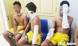 3 cầu thủ Sông Lam Nghệ An bị bỏng nặng vì chùm bóng bay phát nổ