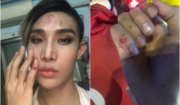 Người mẫu The Face tố bị tài xế Go - Viet đuổi đánh, hành hung