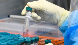 Chuyên gia lý giải về trường hợp tái dương tính với Covid-19 của bệnh nhân số 188