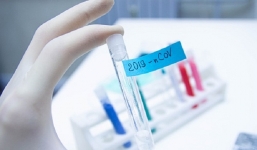 Kit xét nghiệm Covid-19 của Việt Nam được lưu hành ở 27 nước, hàng chục đối tác đặt mua