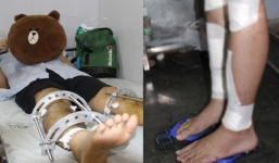 Chàng trai cao 1m7 vẫn cắn răng chịu đau kéo chân để cao hơn vợ 