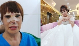 Nhan sắc gây ngỡ ngàng của cô dâu 62 tuổi sau 1 tuần nâng mũi