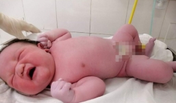 Ca sinh hiếm gặp: Con chào đời nặng hơn nửa yến, bác sĩ lẫn sản phụ đều ngạc nhiên 