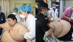 Cách ly chống dịch, thanh niên phải nhập viện khẩn cấp vì tăng 101 kg sau 5 tháng 