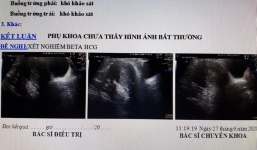 Nghe thầy phán có thai, cả nhà đưa đi đẻ mới phát hiện sự thật bi hài 