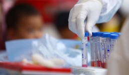 Bộ Y tế lý giải vì sao ca nghi nhiễm COVID-19 người Indonesia dương tính rồi âm tính