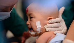 Mẹ hai bé song sinh dính liền nhau chia sẻ xúc động sau ca phẫu thuật 