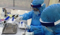 Xét nghiệm sớm âm tính vẫn không thể chủ quan