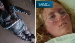 Cô gái bị đóng băng suốt 6 tiếng trong cái lạnh âm 30 độ C, vào bệnh viện bỗng hồi tỉnh