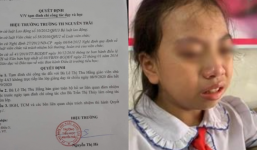 Bé gái lớp 4 giàn giụa nước mắt vì bị cô giáo ở Hà Giang tát đỏ mặt ngay trong buổi học đầu tiên 