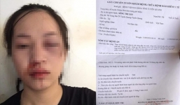 CSGT bị tố vụt gậy vào mặt người vi phạm: Công an Tuyên Quang vào cuộc điều tra 