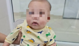 Bé trai 6 tháng mắc bệnh hiếm gặp, chưa từng thấy ở Việt Nam: Chỉ sốt 1 ngày, mặt đầy mẩn đỏ