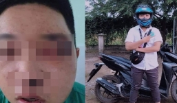 Xôn xao hình ảnh sửu nhi ở Tây Ninh bị 'dạy dỗ' tím tái mặt mũi sau phát ngôn xúc phạm cố nghệ sĩ Chí Tài 