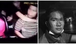 Công an vào cuộc vụ tài xế bị hành khách hành hung, tiết lộ về tình hình sức khỏe hiện tại 