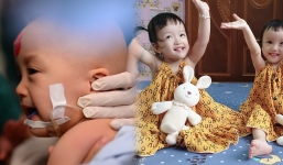 Tròn 1 năm sau ngày Trúc Nhi - Diệu Nhi được tách dính: Người mẹ hé lộ tình hình hiện tại của hai con