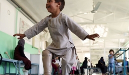 Ấm lòng khoảnh khắc bé 5 tuổi nhảy múa khi được lắp chân giả 