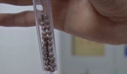 Bé trai nhét 29 viên nam châm vào 'cậu nhỏ', chịu đau đớn suốt 3 tháng