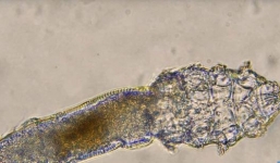 Rùng mình trước cảnh bọ ve oanh tạc trên mặt khi bạn ngủ