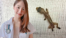 Ngày đầu hành nghề, bác sĩ sốc khi phát hiện tắc kè trong tai bệnh nhân