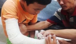 Bán vé số phụ bố mẹ, bé 13 tuổi bị cướp đánh gãy tay