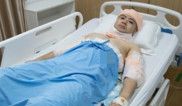 Hành trình 'tút lại vẻ đẹp trai' đầy đau đớn của Akira Phan