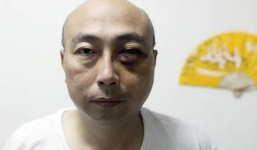 Nghi ngoại tình, vợ Việt dùng dao đâm chồng trọng thương