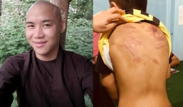 Nhà tu hành đánh tím người bé trai 11 tuổi ngay tại nơi thờ tự