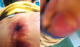 Vụ bé 11 tuổi bị bạo hành ở Bình Thuận: Đề nghị khởi tố nhà tu hành