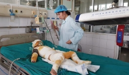 Ghép da cho 2 trẻ bị bỏng nặng vụ cô giáo dùng cồn dạy phòng cháy