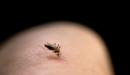 Lý do kỳ lạ khiến vết muỗi đốt ngứa dai dẳng